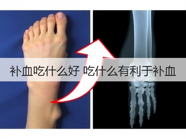 补血吃什么好 吃什么有利于补血(图2) 补血吃什么好 吃什么有利于补血(图2)