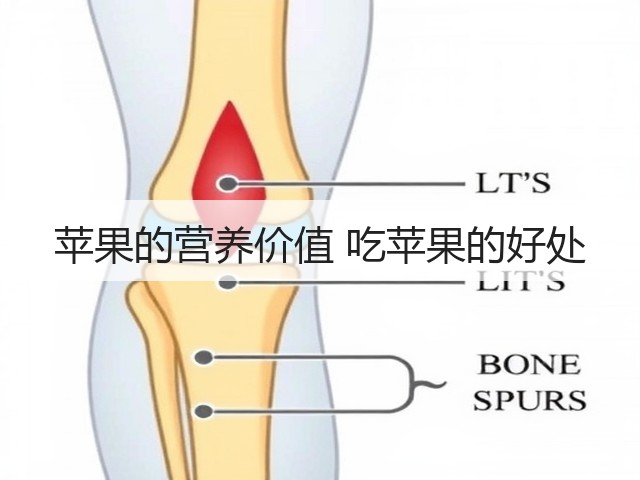 苹果的营养价值 吃苹果的好处(图3) 苹果的营养价值 吃苹果的好处(图3)