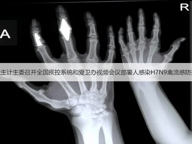 国家卫生计生委召开全国疾控系统和爱卫办视频会议部署人感染H7N9禽流感防控工作(图1) 国家卫生计生委召开全国疾控系统和爱卫办视频会议部署人感染H7N9禽流感防控工作(图1)